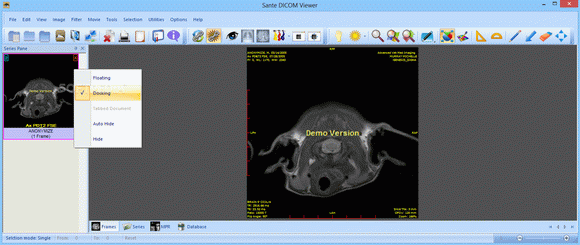 Sante DICOM Viewer Pro Crack With Activation Code 2024